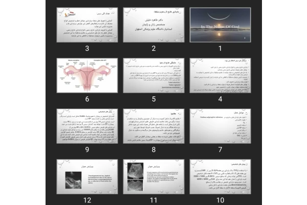 پاورپوینت بارداری خارج از رحم و سقط