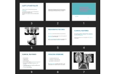 پاورپوینت Developmental Disturbances of the Face and jaws