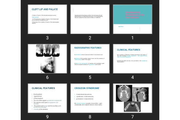 پاورپوینت Developmental Disturbances of the Face and jaws