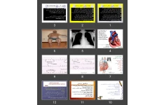 پاورپوینت Respiratory Diseases-Corpulmonale and ARDS