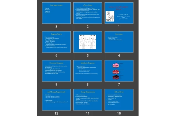 پاورپوینت حمایت های تغذیه ای در بیماران سوختگی