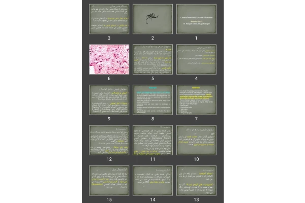 پاورپوینت Central nervous system diseases