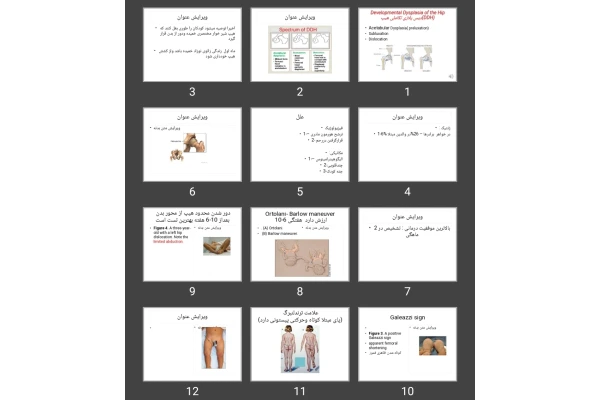 پاورپوینت دیس پلازی تکاملی هیپ