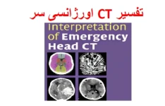 تفسیر CT Scan سر