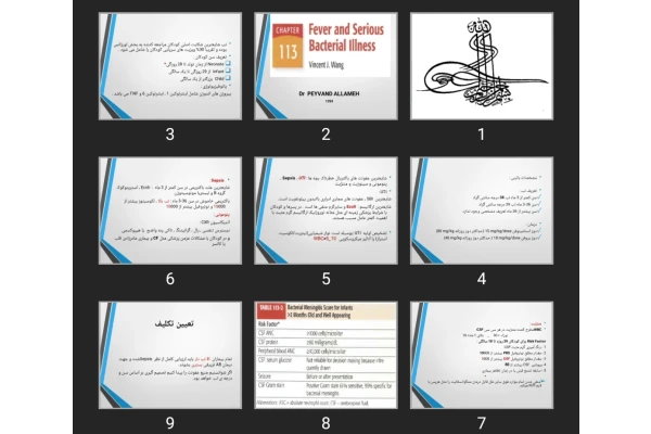 پاورپوینت تب در کودکان SBI