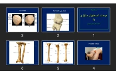 پاورپوینت مبحث استخوان ساق و پا