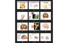 پاورپوینت Diencephalon