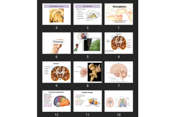 پاورپوینت Diencephalon
