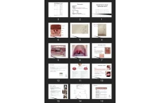 پاورپوینت Respiratory Tract Infection (RTI)
