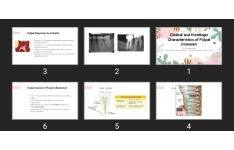 پاورپوینت Clinical and Histologic Characteristics of Pulpal Diseases
