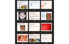 پاورپوینت کودک Haemophilus Legionella Bordetella Brucella Francisella