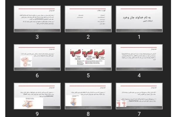 پاورپوینت اختلالات کلیوی