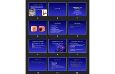 پاورپوینت بیماری های مری DISEASES OF THE ESOPHAGUS