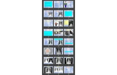 پاورپوینت Chest X-ray Interpretation