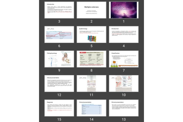 پاورپوینت Multiple sclerosis