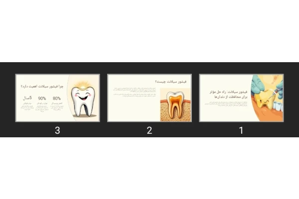 پاورپوینت فیشور سیلانت: راه حل مؤثر برای محافظت از دندان‌ها