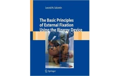 The Basic Principles of External Fixation Using the Ilizarov Device-کتاب انگلیسی