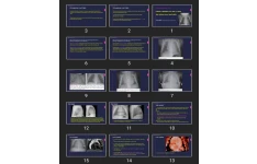 پاورپوینت Pediatric radiologists are fond of saying that children are not small adults