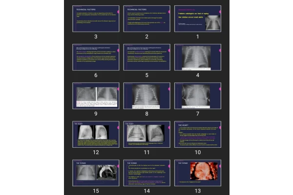 پاورپوینت Pediatric radiologists are fond of saying that children are not small adults