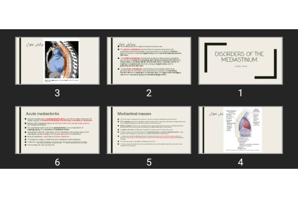 پاورپوینت Disorders of the Mediastinum