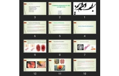 پاورپوینت COMMON DISEASES OF THE ANORECTUM