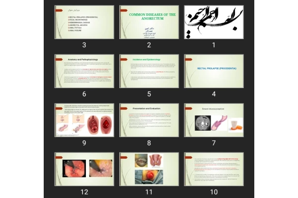 پاورپوینت COMMON DISEASES OF THE ANORECTUM