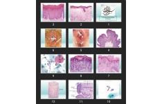 پاورپوینت  17-Female Genital System and Breast