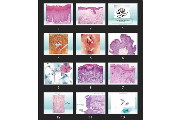 پاورپوینت  17-Female Genital System and Breast