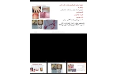 پاورپوینت بیماری های قارچی فرصت طلب ناشی ازمخمر ها