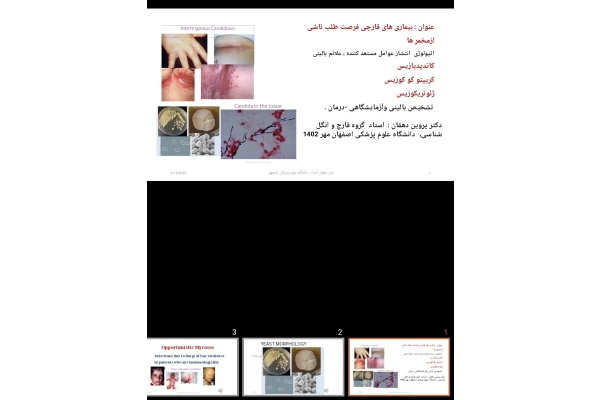 پاورپوینت بیماری های قارچی فرصت طلب ناشی ازمخمر ها