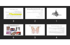 پاورپوینت آزمایش (RF) Rheumatoid factor و Anti-ccp