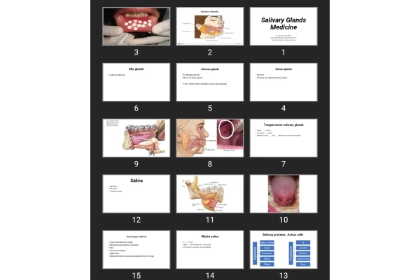 پاورپوینت Salivary Glands Medicine
