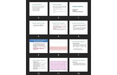 پاورپوینت Ventricular Arrhythmias