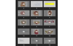 پاورپوینت History taking and physical examination female genital tract