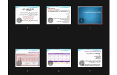 جزوه اختلالات هدایتی (بلوک های قلبی)
