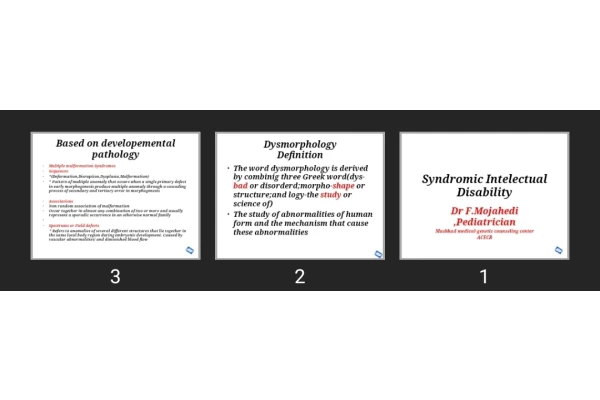 پاورپوینت Syndromic Intelectual Disability