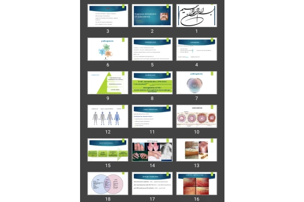 پاورپوینت Diagnosis & treatment Of scleroderma