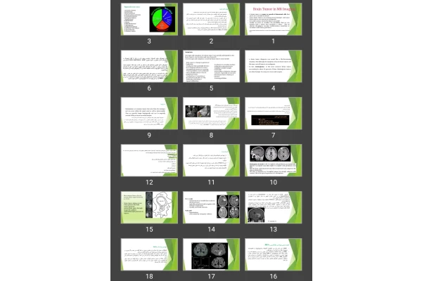 پاورپوینت تومور مغزی در mri