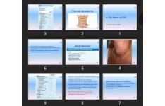 پاورپوینت thyroid disorders