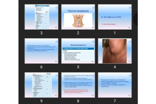 پاورپوینت thyroid disorders