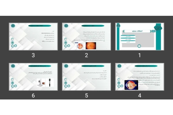 پاورپوینت اختلالات شبکیه