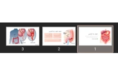 پاورپوینت التهاب حاد آپاندیس