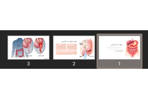 پاورپوینت التهاب حاد آپاندیس