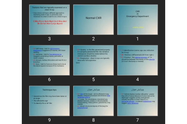 پاورپوینت CXR in Emergency Department