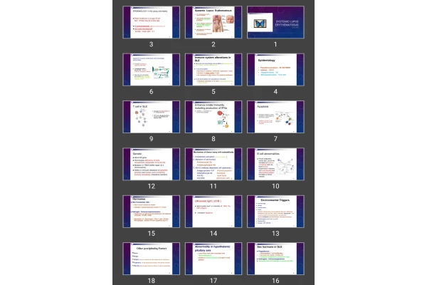 پاورپوینت Systemic lupus erythematosus