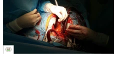 راهنمای عمل جراحی قلب