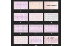 پاورپوینت Cardiac Arrhythmias