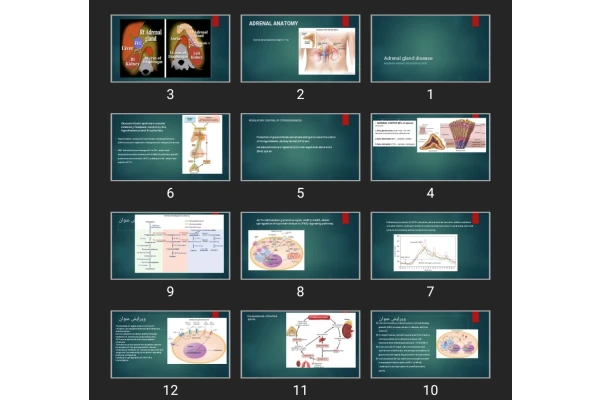 پاورپوینت Adrenal gland disease