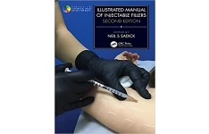 دانلود کتاب Illustrated Manual of Injectable Fillers زبان انگلیسی نسخه اورجینال