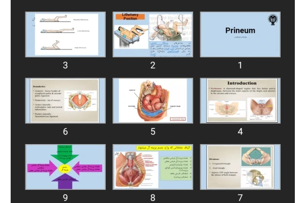 پاورپوینت Prineum